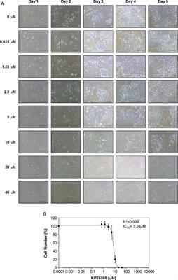 KPT6566 induces apoptotic cell death and suppresses the tumorigenicity of testicular germ cell tumors
